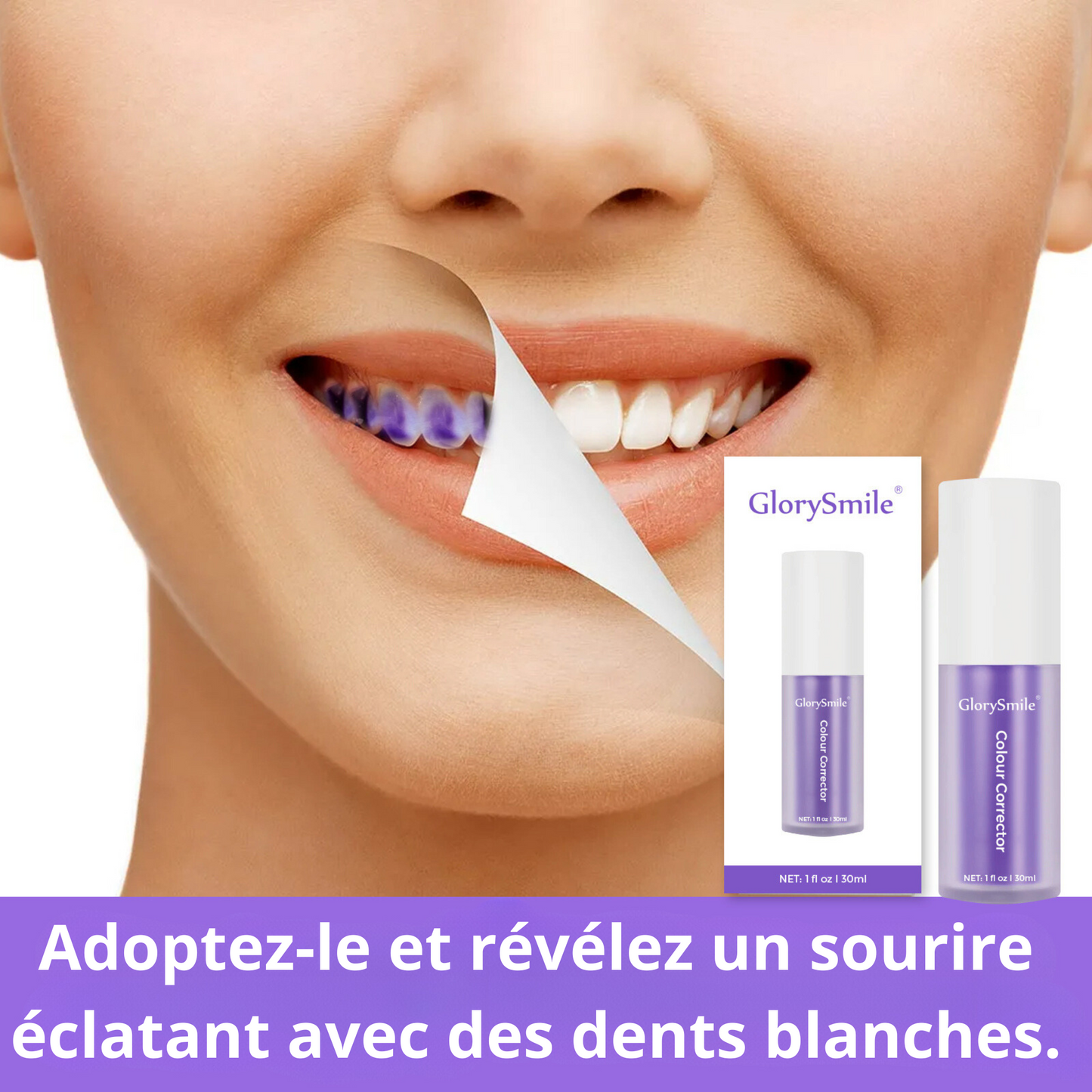 Glory smile pour donner de l'éclat à vos dents